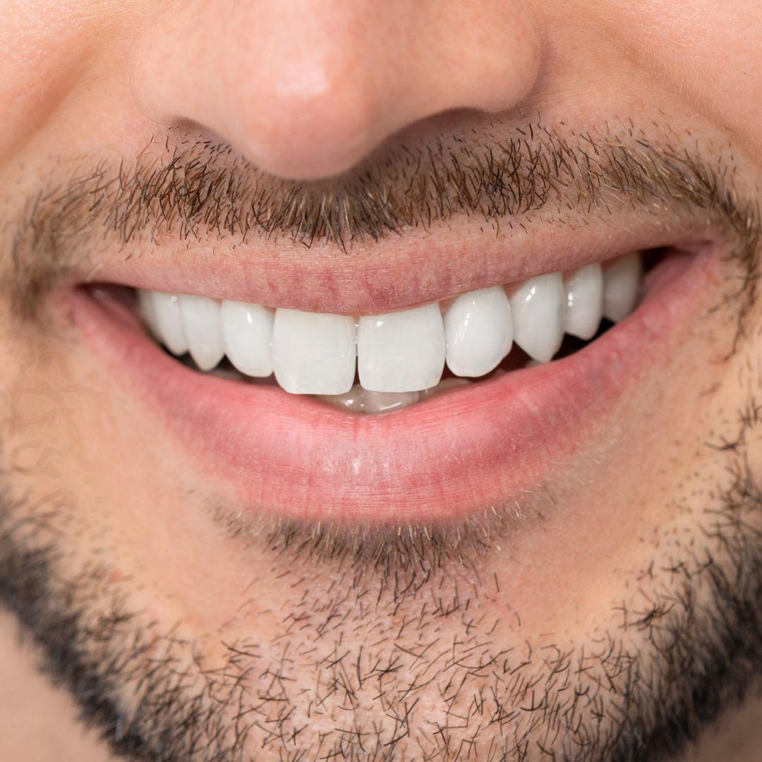 Close-up del sorriso perfetto di un uomo sulla trentina