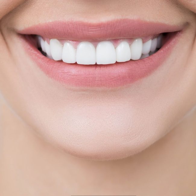 Un close-up di un sorriso smagliante di un soggetto femminile
