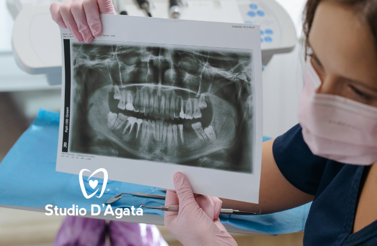 Una dentista con guanti e mascherina mostra al paziente una radiografia della bocca in cui manca visibilmente un dente